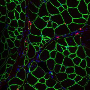 Impact-of-FoxO3a-overexpression-on-muscle-pathophysiology-in-Pompe-disease