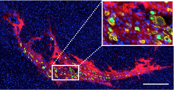 Local-delivery-of-human-MuStem-cells-into-infarcted-heart.png