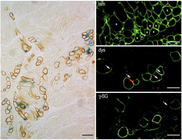 Long-term-muscle-repair-in-dystrophic-dogs-following-transplantation-of-allogeneic-MuStem-cells.png