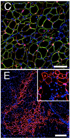 Muscle-regenerative-potential-of-human-MuStem-cells-after-injection-into-injured-tissue.png